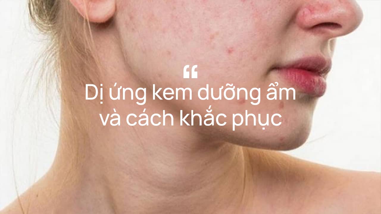 Dị ứng kem dưỡng ẩm và cách khắc phục